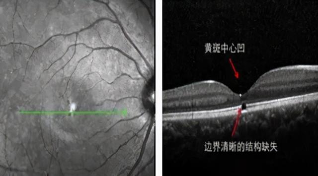 激光防护(激光个人防护措施)  第3张